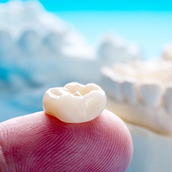 dentist in Virginia Beach holding a dental crown on their finger