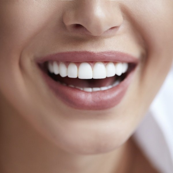 Closeup of flawless smile after dental implant tooth replacement